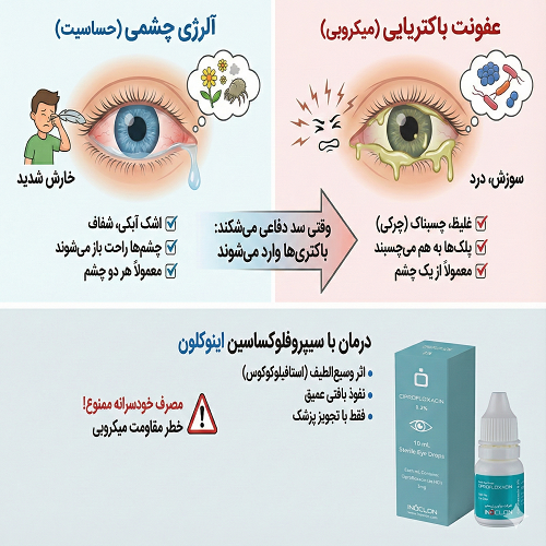 سیپروفلوکساسین چشمی