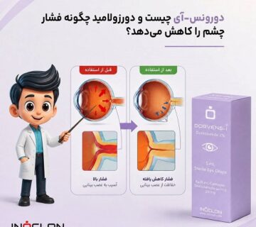 : قطره چشمی دورونس-آی حاوی دورزولامید برای کاهش فشار داخل چشم