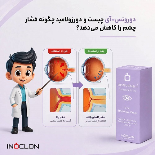 : قطره چشمی دورونس-آی حاوی دورزولامید برای کاهش فشار داخل چشم