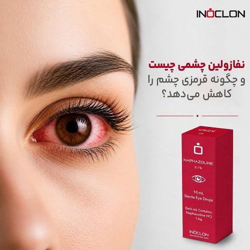 قطره چشمی نفازولین ۰٫۱ درصد برای تسکین موقت قرمزی و احتقان چشم